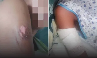 Natasha : «Linn bat mwa, mord mwa ek tir enn bout laser» 