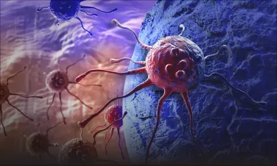 Cancer : le dépistage précoce est important