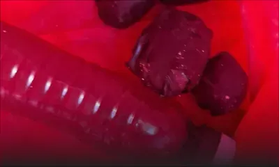 En l’espace d’un mois : des millions de roupies de drogue synthétique hors circuit