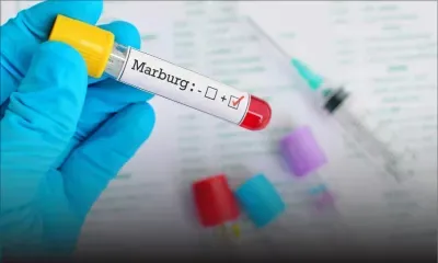 Détection dans deux pays africains : ce qu’il faut savoir sur le virus de Marburg