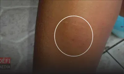 À Curepipe : un écolier sème le trouble parmi ses camarades