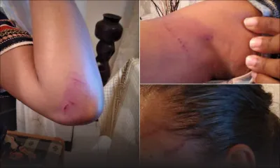 Violence domestique - Abigaël : «Il m’a dit d’acheter un miroir car je ne me reconnaîtrai plus…»