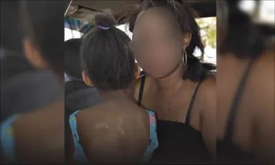 Dans un village du Nord : elle accuse la compagne de son père de l’avoir ébouillantée 