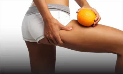 Cellulite : faites-lui la peau !