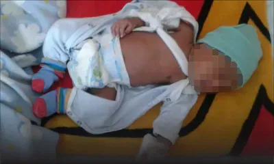 Dans un hôpital public : le bras de leur bébé se brise à l’accouchement