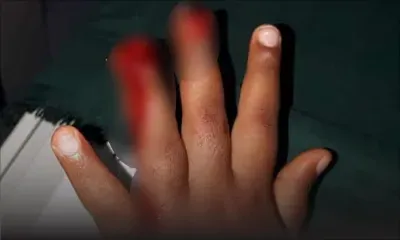 Une fillette de trois ans blessée à la main : bras de fer entre les parents et l’établissement scolaire