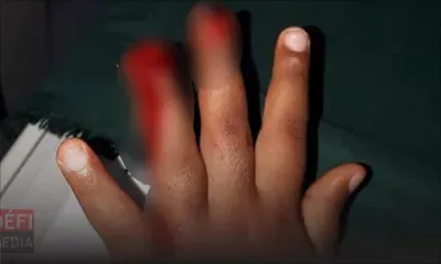 Fillette blessée dans une garderie : la direction de l’établissement s’explique 