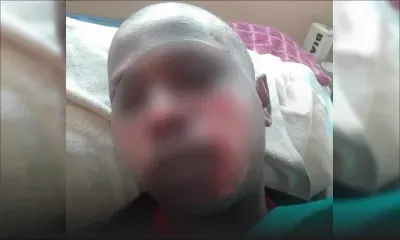 Au lieu du diesel, il a utilisé de l’essence : un cracheur de feu brûlé au visage