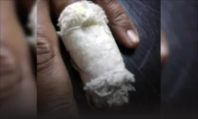 A Pointe-aux-Sables : un homme tailladé au visage