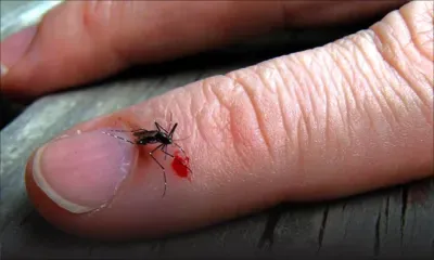 Astuce de grand-mère: Soulagez les piqûres de moustiques