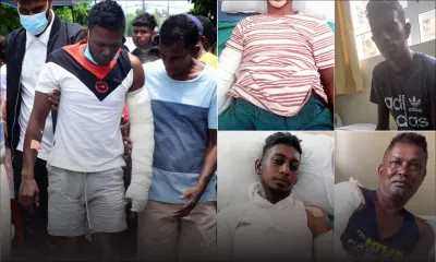 Six victimes à la Burns Unit : une tragédie gravée dans la chair 