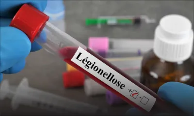 Santé - Légionellose : ce qu’il faut savoir