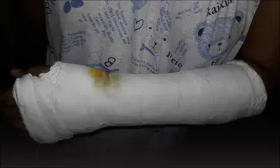 Salle de gym à Quatre-Bornes : gravement blessée, elle déplore «l’insensibilité» du coach