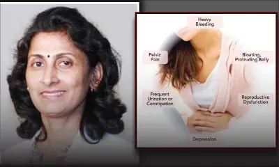 Fibroid: Debunking misinformation