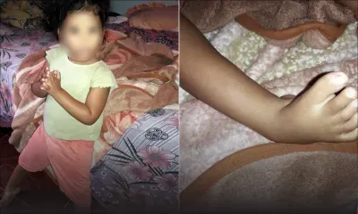 Orthopédie : le combat d’une mère pour sauver sa fille