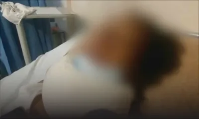 À la suite d’une dispute : un jeune de 22 ans agressé au sabre à La-Tour-Koenig