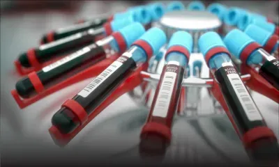 Metropolis : offre promotionnelle sur des examens médicaux