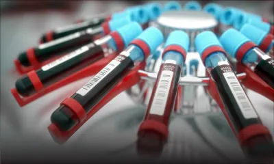 Services hospitaliers publics : dysfonctionnement au laboratoire central