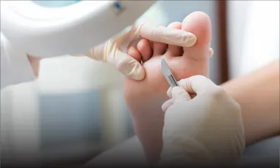 Soins: ne courez pas le risque de négliger vos pieds