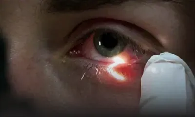 Sécurité sociale : ayant perdu l’usage d’un œil, il réclame une aide de l’État