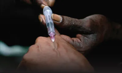 Selon l’ONG CUT: entre 9000 et 11000 usagers de drogues par voie intraveineuse à Maurice