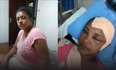 Souffrant d’un kyste cérébral, elle est privée de sa pension d’invalidité : un parcours de combattant pour Noelly Raboude 