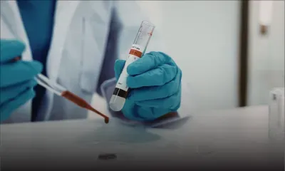 Leptospirose : huit cas recensés, dont trois décès depuis le début de l’année