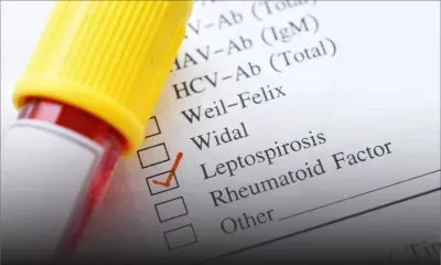 Santé publique - Leptospirose : la Santé redoute une aggravation de la situation