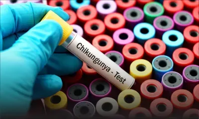 Au Cœur de l’Info – Nipah, MERS, Chikungunya : ce qu’il faut savoir sur les risques sanitaires