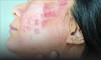 Citron, dentifrice, huiles : le vrai prix des « astuces » beauté virales