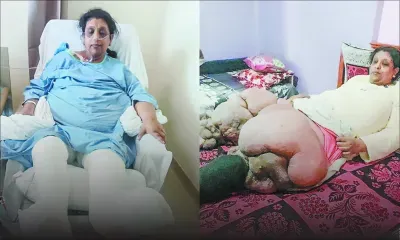 Atteinte d’éléphantiasis - Pushpa Devi : 50 kilos de souffrance en moins 