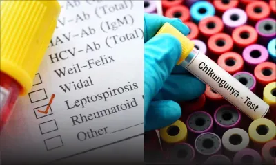 Santé : plus de 200 cas de chikungunya, deux nouveaux cas de leptospirose