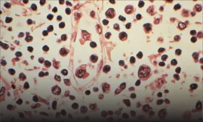 L'hantavirus agite une complosphère hantée par le Covid