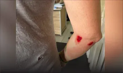 Agression à Grand-Bassin : un touriste italien pris pour cible
