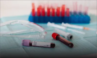 Cas suspect de Mpox : un sexagénaire placé en isolement à l’hôpital du Nord