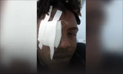 Attaque à l’acide pour une dette de Rs 2,500 -Blackwell, 25 ans: «Akoz monn al rod mo larzan, zordi monn perdi mo lizie»