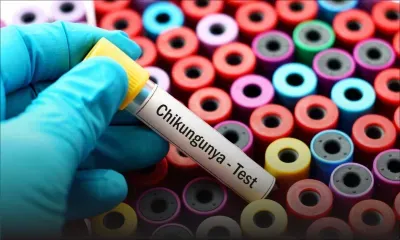 Chikungunya : les États-Unis placent Maurice sous surveillance sanitaire