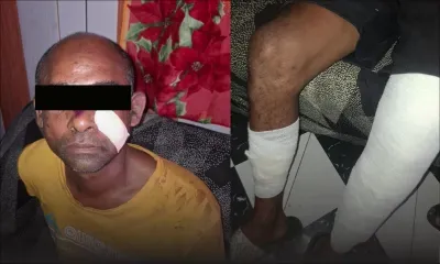 Vol avec violence : un agent de sécurité agressé à coups de barres de fer et dépouillé en pleine nuit