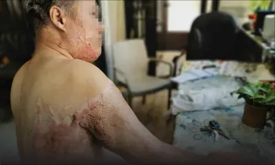 Attaqué à l’acide en deux occasions et aucune arrestation : Gaëtan, 68 ans, vit dans la peur 