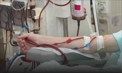 76 patients dialysés décédés depuis le 5 mars