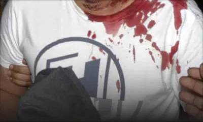 Accident à Sorèze: deux blessés à déplorer