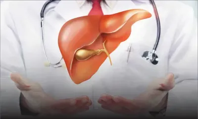 Non-Alcoholic Steatohepatitis Disease : the Silent Killer