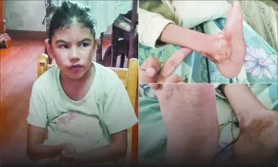 ​​​​​​​Appel à solidarité - Sanaa, 5 ans : son combat pour marcher, enfin