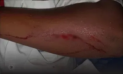 Bousculade entre collégiens : le petit Ezéchiel, 11 ans, livré à lui-même 