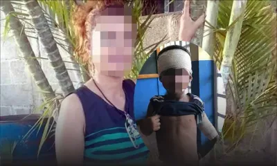 Croyant le corriger : elle brûle son petit-fils de trois ans avec une cuillère chaude