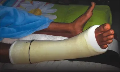 Loisir extrême : un jeune se blesse après un saut de 12 mètres au Caudan