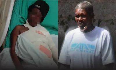 Tentative de meurtre : une femme brûlée vive par son compagnon