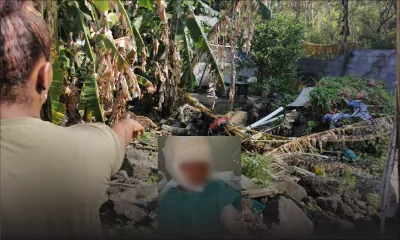 Brûlé au visage : le petit Kyliam, 3 ans, doit subir une troisième intervention