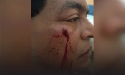 Rixe dans une bijouterie : un sexagénaire sauvagement tabassé par un collègue