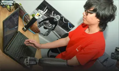 Ottobock Mauritius : bionic hand prosthesis arrives in Mauritius